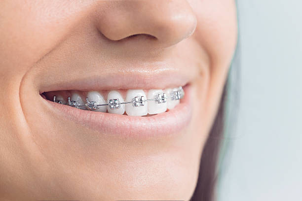 Why Choose Us for Your Dental Needs in Oolitic, IN